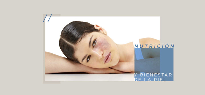 Bienestar de la piel a través de nutrición antiinflamatoria